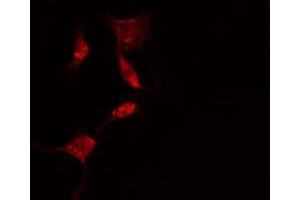 ABIN6275623 staining  HepG2 cells by IF/ICC. (CCT5 antibody  (Internal Region))