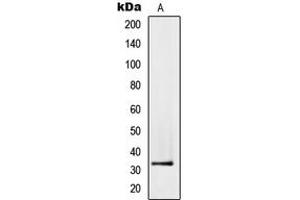 Western blot analysis of PMEPA1 expression in PC3 (A) whole cell lysates.