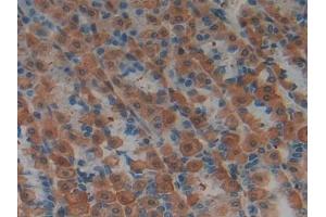Detection of LIFR in Rat Stomach Tissue using Polyclonal Antibody to Leukemia Inhibitory Factor Receptor (LIFR) (LIFR antibody  (AA 152-291))
