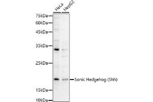 Western blot analysis of extracts of various cell lines, using Sonic Hedgehog (Shh) antibody (ABIN6134067, ABIN6147741, ABIN6147743 and ABIN6223662) at 1:1000 dilution. (Sonic Hedgehog antibody)