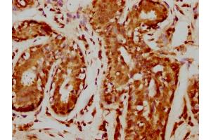 IHC image of nforHU diluted at 1:20 and staining in paraffin-embedded human breast cancer performed on a Leica BondTM system. (HIST1H1C antibody  (AA 100-112))