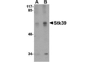 Western Blotting (WB) image for anti-serine threonine Kinase 39 (STK39) (C-Term) antibody (ABIN1030708) (STK39 antibody  (C-Term))