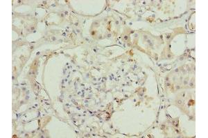 Immunohistochemistry of paraffin-embedded human kidney tissue using ABIN7142940 at dilution of 1:100 (ILVBL antibody  (AA 45-344))