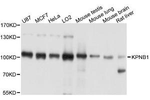 Western blot analysis of extracts of various cell lines, using KPNB1 antibody. (KPNB1 antibody  (AA 250-350))