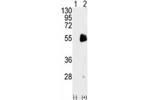 Western blot analysis of PRMT7 antibody and 293 cell lysate either nontransfected (Lane 1) or transiently transfected with the PRMT7 gene (2). (PRMT7 antibody  (AA 660-692))