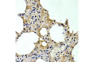 Immunohistochemistry of paraffin-embedded rat lung using HDC antibody at dilution of 1:200 (400x lens).