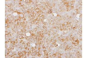 IHC-P Image Immunohistochemical analysis of paraffin-embedded SW480 xenograft, using Caspase 1 alpha, antibody at 1:100 dilution. (Caspase 1 antibody)