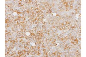 IHC-P Image Immunohistochemical analysis of paraffin-embedded SW480 xenograft, using Caspase 1 alpha, antibody at 1:100 dilution.