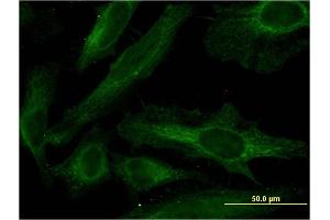 Immunofluorescence of monoclonal antibody to PDE4C on HeLa cell. (PDE4C antibody  (AA 1-99))