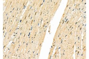 ABIN6261695 and ABIN6277334 at 1/100 staining Rat heart tissue by IHC-P. (FBXO32 antibody  (N-Term))
