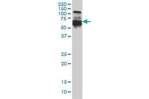 IRF5 monoclonal antibody (M03), clone 1H6 Western Blot analysis of IRF5 expression in A-431 . (IRF5 antibody  (AA 395-504))