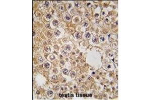 Formalin-fixed and paraffin-embedded human testis tissue reacted with M6PR antibody (N-term) (ABIN389291 and ABIN2839413) , which was peroxidase-conjugated to the secondary antibody, followed by DAB staining. (M6PR antibody  (N-Term))