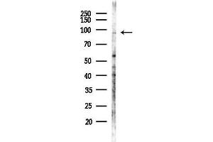 Western blot analysis of lysates from MDA-MB-231 cells(heat-shock,45 min treatment), using CDH9 Antibody at 1/1000 dilution.