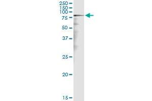 Immunoprecipitation of CALD1 transfected lysate using anti-CALD1 MaxPab rabbit polyclonal antibody and Protein A Magnetic Bead , and immunoblotted with CALD1 purified MaxPab mouse polyclonal antibody (B01P) . (Caldesmon antibody  (AA 1-538))