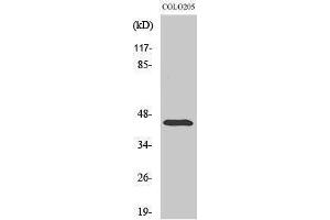 Western Blotting (WB) image for anti-Abhydrolase Domain Containing 12 (ABHD12) (Internal Region) antibody (ABIN3173622) (ABHD12 antibody  (Internal Region))