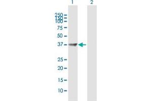 Western Blot analysis of PPP1R3C expression in transfected 293T cell line by PPP1R3C MaxPab polyclonal antibody. (PPP1R3C antibody  (AA 1-317))