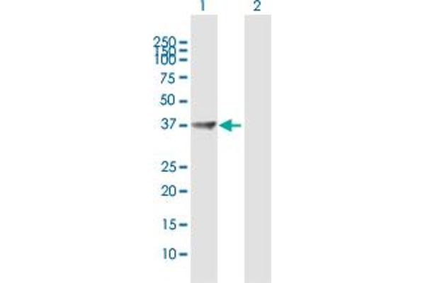 PPP1R3C Antikörper  (AA 1-317)