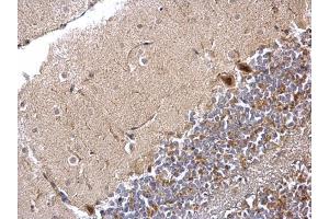 IHC-P Image PPP1CB antibody detects PPP1CB protein at nucleus and cytosol on mouse hind brain by immunohistochemical analysis. (PPP1CB antibody  (Center))