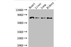 Western Blot Positive WB detected in: Mouse heart tissue, Mouse liver tissue, Mouse lung tissue, Mouse kidney tissue All lanes: FZD8 antibody at 2.