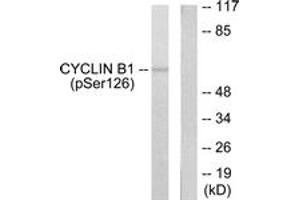 Western blot analysis of extracts from NIH-3T3 cells treated with EGF 200ng/ml 15', using Cyclin B1 (Phospho-Ser126) Antibody. (Cyclin B1 antibody  (pSer126))