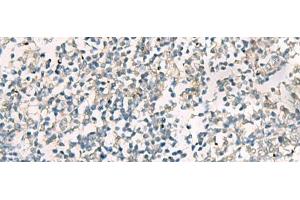 Immunohistochemistry (Paraffin-embedded Sections) (IHC (p)) image for anti-serpin Peptidase Inhibitor, Clade B (Ovalbumin), Member 4 (SERPINB4) antibody (ABIN7251949)