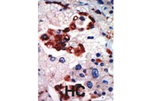 Immunohistochemistry (IHC) image for anti-Protein Kinase C, iota (PRKCI) antibody (ABIN3002935) (PKC iota antibody)