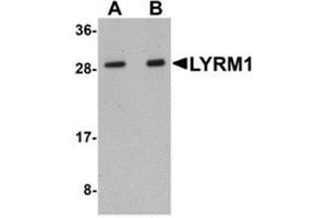 Western blot analysis of LYRM1 in human liver tissue lysate with LYRM1 antibody at (A) 1 and (B) 2 μg/ml. (LYRM1 antibody  (Center))