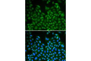 Immunofluorescence analysis of A549 cell using LHX8 antibody. (LHX8 antibody)