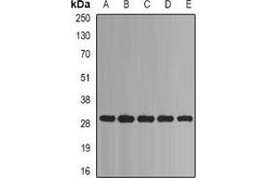 Western blot analysis of PSMA1 expression in Jurkat (A), Hela (B), HepG2 (C), mouse liver (D), mouse heart (E) whole cell lysates. (PSMA1 antibody)