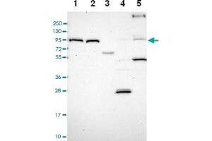 Western blot analysis of Lane 1: RT-4 Lane 2: U-251 MG Lane 3: Human Plasma Lane 4: Liver Lane 5: Tonsil with TRPV2 polyclonal antibody . (TRPV2 antibody)