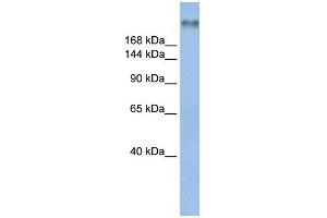 WB Suggested Anti-SCN8A Antibody Titration:  0. (SCN8A antibody  (Middle Region))