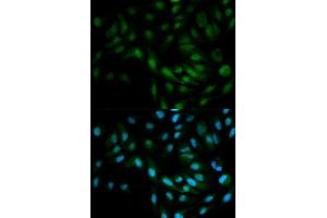 Immunofluorescence analysis of MCF7 cell using MAPK7 antibody.