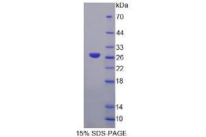 SDS-PAGE analysis of Human GFM2 Protein. (GFM2 Protein)