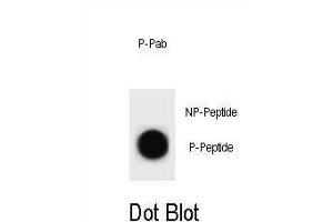 Dot blot analysis of CCNB2 Antibody (Phospho ) Phospho-specific Pab (ABIN1881159 and ABIN2839951) on nitrocellulose membrane. (Cyclin B2 antibody  (pThr359))