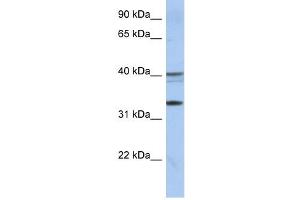 TEX264 antibody used at 1 ug/ml to detect target protein. (TEX264 antibody  (Middle Region))