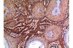 Immunohistochemistry (IHC) analysis of paraffin-embedded Human Skin, antibody was diluted at 1:100. (alpha 2 Macroglobulin antibody  (Internal Region))