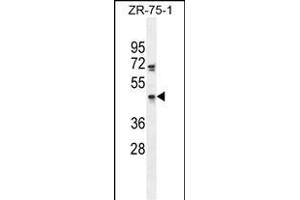 ZN Antibody (C-term) (ABIN655256 and ABIN2844853) western blot analysis in ZR-75-1 cell line lysates (35 μg/lane).