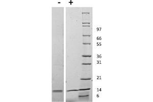 SDS-PAGE of Mouse Interleukin IL-31 Recombinant Protein SDS-PAGE of Mouse Interleukin-31 Recombinant Protein. (IL-31 Protein)