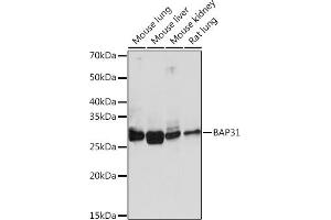 Western blot analysis of extracts of various cell lines, using B Rabbit mAb (ABIN1680181, ABIN7101458, ABIN7101459 and ABIN7101460) at 1:1000 dilution. (BCAP31 antibody)