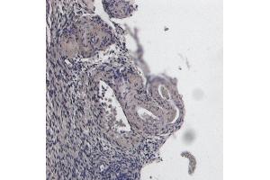 Immunohistochemistry (IHC) image for anti-Forkhead Box L2 (FOXL2) (C-Term) antibody (ABIN185040)