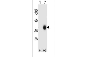 Western blot analysis of FCAR (arrow) using rabbit polyclonal FCAR Antibody (Center) (ABIN656839 and ABIN2846047).