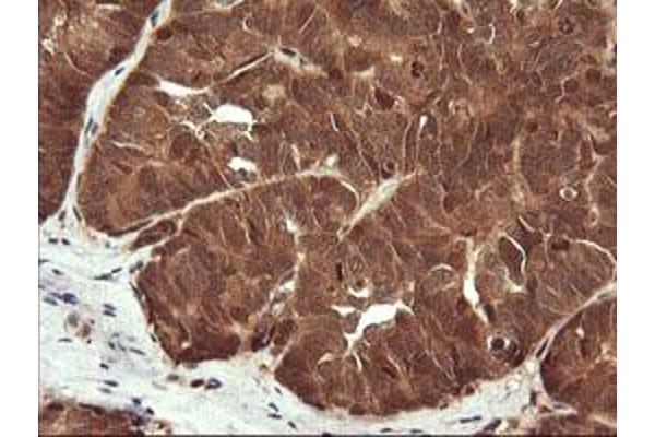 LZIC antibody