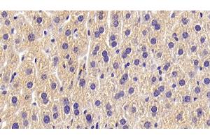 Detection of ALPL in Mouse Liver Tissue using Polyclonal Antibody to Alkaline Phosphatase, Tissue-nonspecific (ALPL) (ALPL antibody  (AA 18-335))
