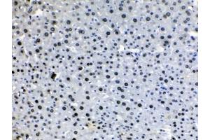 IHC testing of FFPE mouse liver tissue with HDGF antibody at 1ug/ml.
