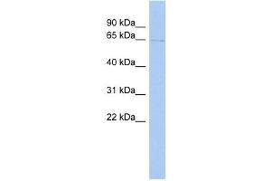 TIGD1 antibody used at 1 ug/ml to detect target protein.