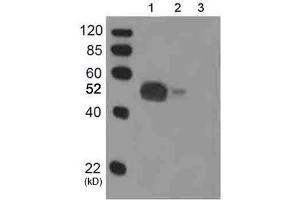 Loading: 1. (His Tag antibody  (Biotin))