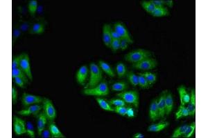 Immunofluorescent analysis of HepG2 cells using ABIN7154273 at dilution of 1:100 and Alexa Fluor 488-congugated AffiniPure Goat Anti-Rabbit IgG(H+L)