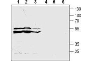 Western blot analysis of acute monocytic leukemia THP-1 (lanes 1 and 4), promyelocytic leukemia HL-60 (lanes 2 and 5) and chronic myelogenous leukemia K562 (lanes 3 and 6) human cell lysates: - 1-3. (CasLTR2 antibody  (3rd Extracellular Loop))
