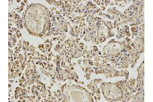 Immunohistochemistry (IHC) image for anti-4-Aminobutyrate Aminotransferase (ABAT) antibody (ABIN1876487) (ABAT antibody)