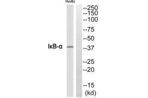 Western Blotting (WB) image for anti-Nuclear Factor of kappa Light Polypeptide Gene Enhancer in B-Cells Inhibitor, alpha (NFKBIA) (N-Term) antibody (ABIN7184467)